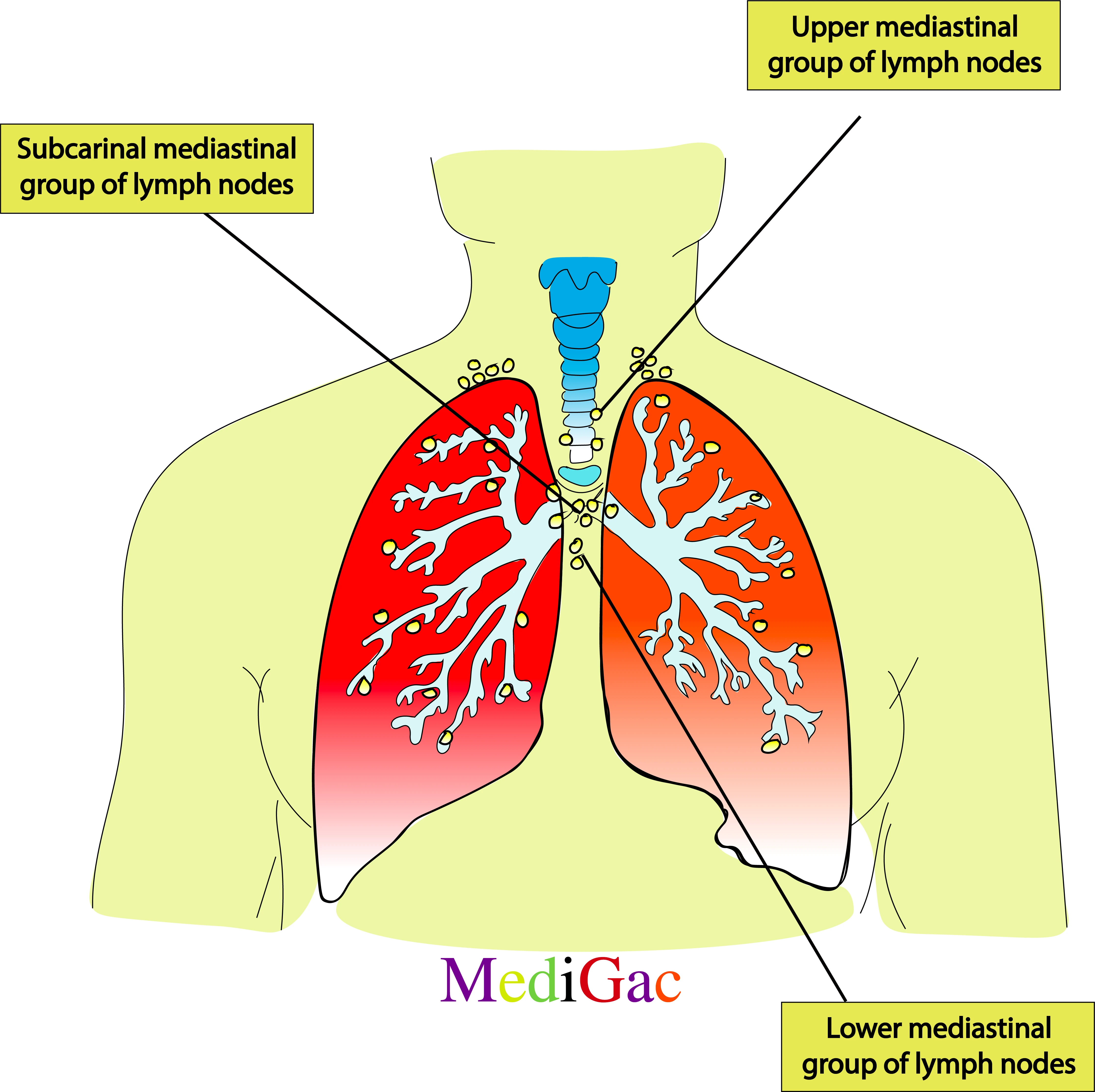 Mediastinal lymph nodes